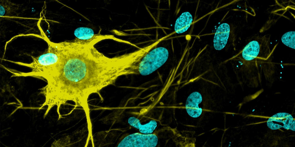 cell shaped like a neuron in yellow.