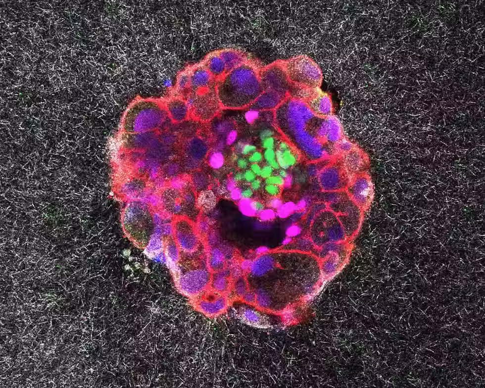A ball of cells seen in the microscope, in red fluorescence, on top of a darker background