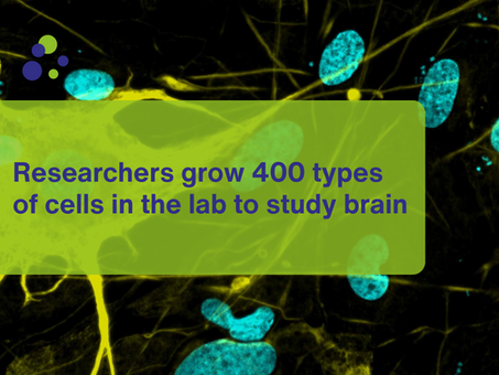 Researchers grow 400 types of cells in the lab to study brain