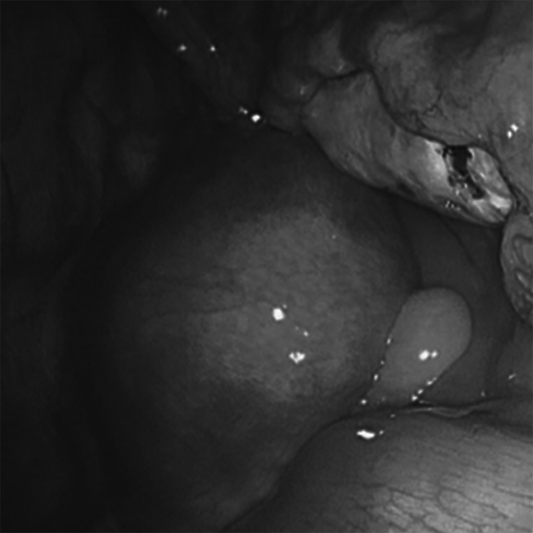 Insides 1 Black and White.png