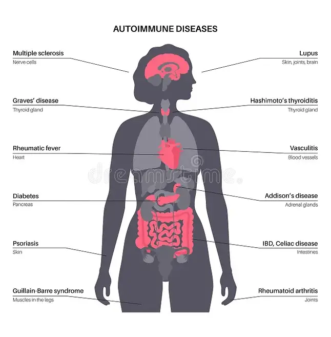 malattie-autoimmuni-patologie-nel-corpo-umano-sintomi-di-malattia-quando-il-sistema-immuni