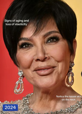 Kris Jenner’s Transformation before