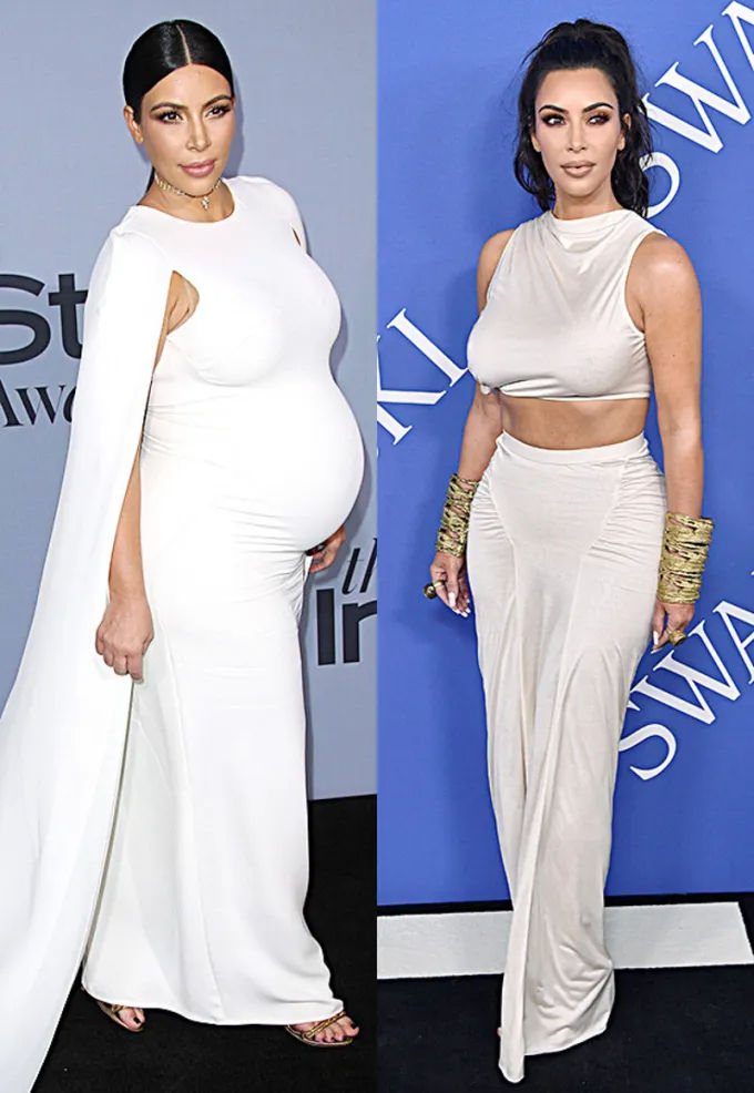 Before and after image inspired by Kim Kardashian, showing subtle enhancements with fuller lips, lifted cheeks, and contoured jawline using dermal fillers.