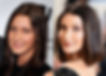 Before and after photo inspired by Bella Hadid, featuring refined nose shape, lifted brow area, and balanced cheek volume through non-surgical treatments.