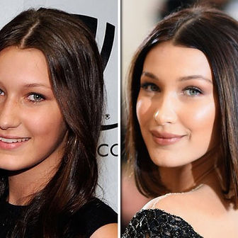 Bella Hadid and the Power of Facial Harmony