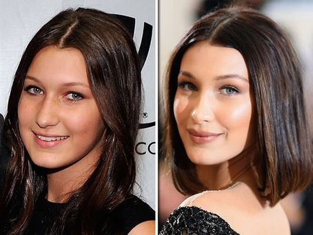 Bella Hadid and the Power of Facial Harmony