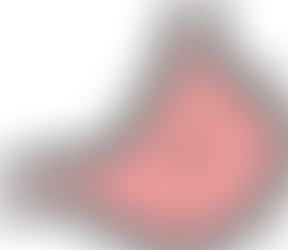 ピロリ菌を除菌した後も内視鏡(胃カメラ)での定期検診をすすめする理由