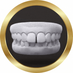 casos invisa (250 × 250 px) (2).gif