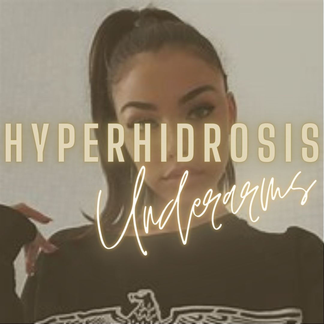 Botox injection treatment to prevent excess sweating from the underarms armpits