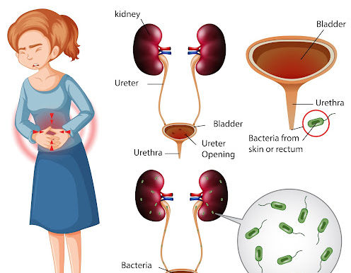 NON- STOP Dripping 💧