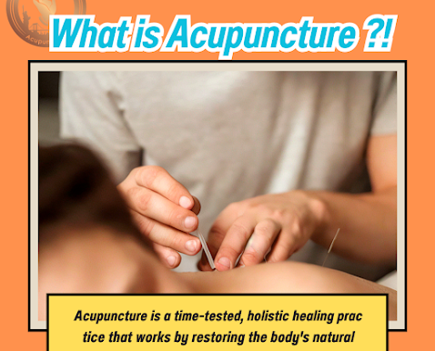 What is Acupuncture ⁉️
