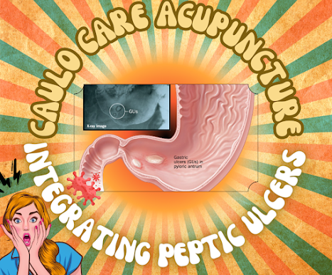 Integrating Western & TCM for Peptic Ulcers