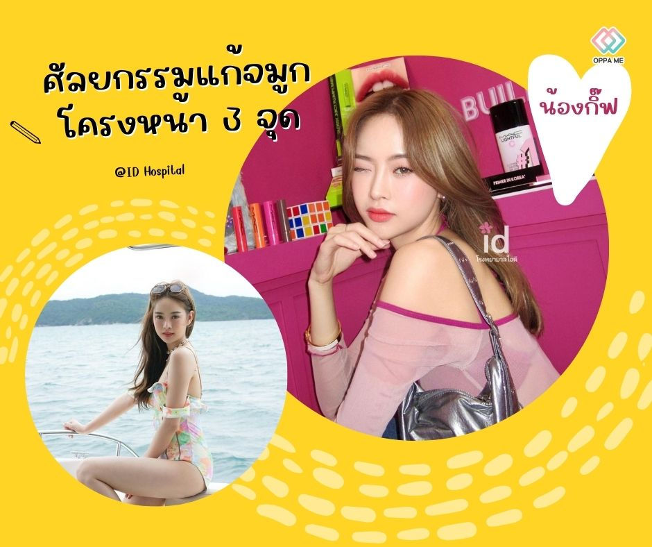 รีวิวศัลยกรรมแก้จมูก + โครงหน้า 3 จุด โรงพยาบาลศัลยกรรมไอดี (ID Hospital)