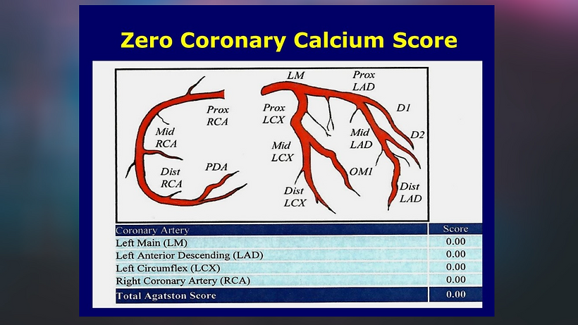 ZERO Calcium Score (1).png