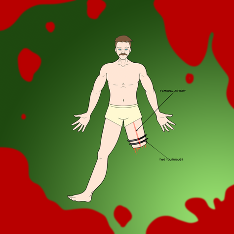 Stopping the Red Tide: How to Address Catastrophic Hemorrhage in the CABCDE Model
