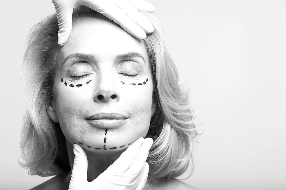 Plastic Surgery Marks