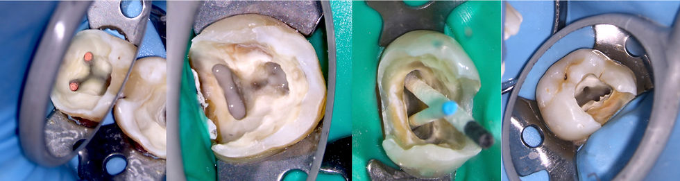 Page endodontia com microsópio.jpg
