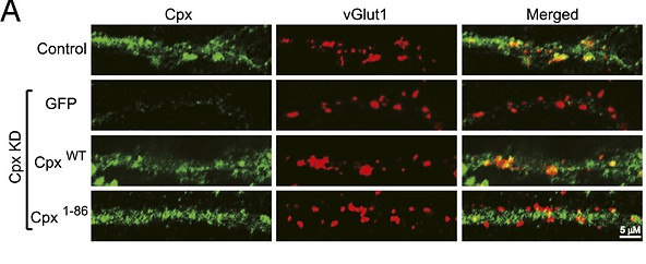 pnas.1609917113fig02.jpg