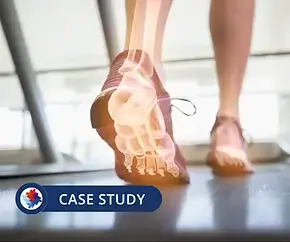 Preventing Foot Injury Claims and Reducing Worker's Compensation claims by 72 .webp