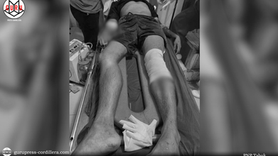 19-yr.-old dies after road accident in Tabuk City