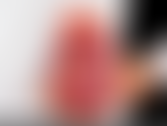 Chronic Kidney Disease now Baguio's top leading cause of death