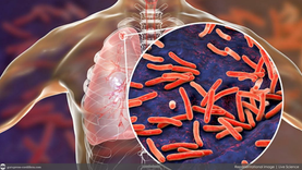415 TB cases recorded in Kalinga; health officials urge early testing and completion of treatment