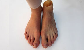 silicone-foot-prosthesis-500x500.jpg