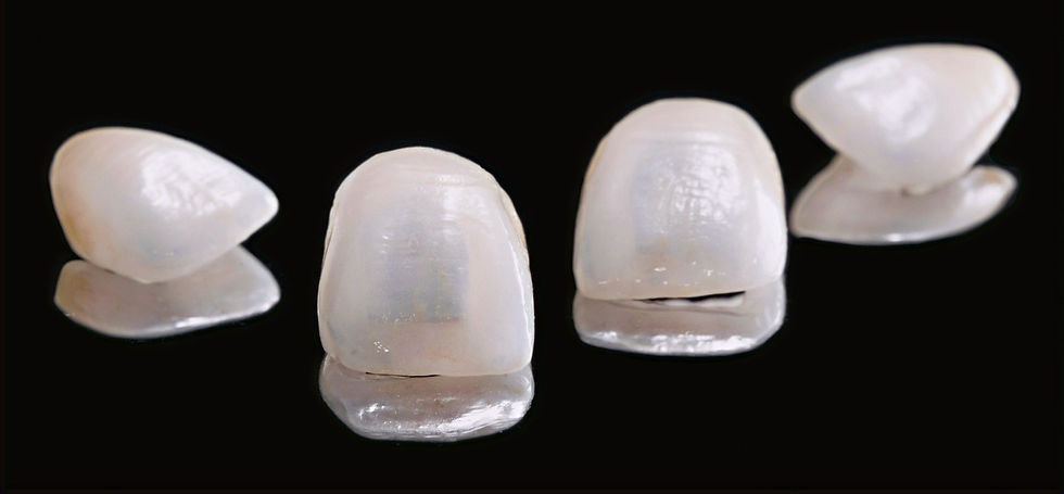 dental veneers