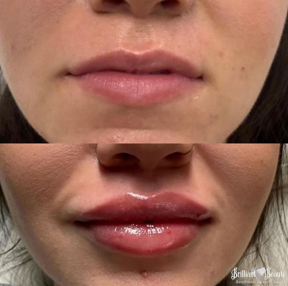 Lips