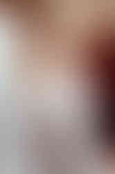 Grims Dyke Hotel evening wedding photos