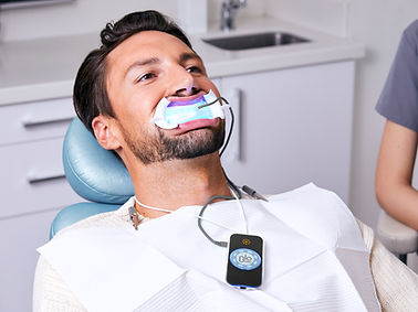 Whitening Procedure Closeup_Male_GrayClipsCordDevice.jpg