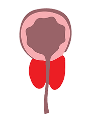 Benign-Prostatic-Hypertrophy-(BPH)