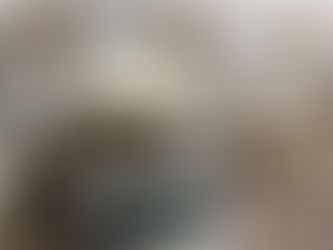 PF prende passageira de voo internacional com droga dentro de volumes fixados ao corpo