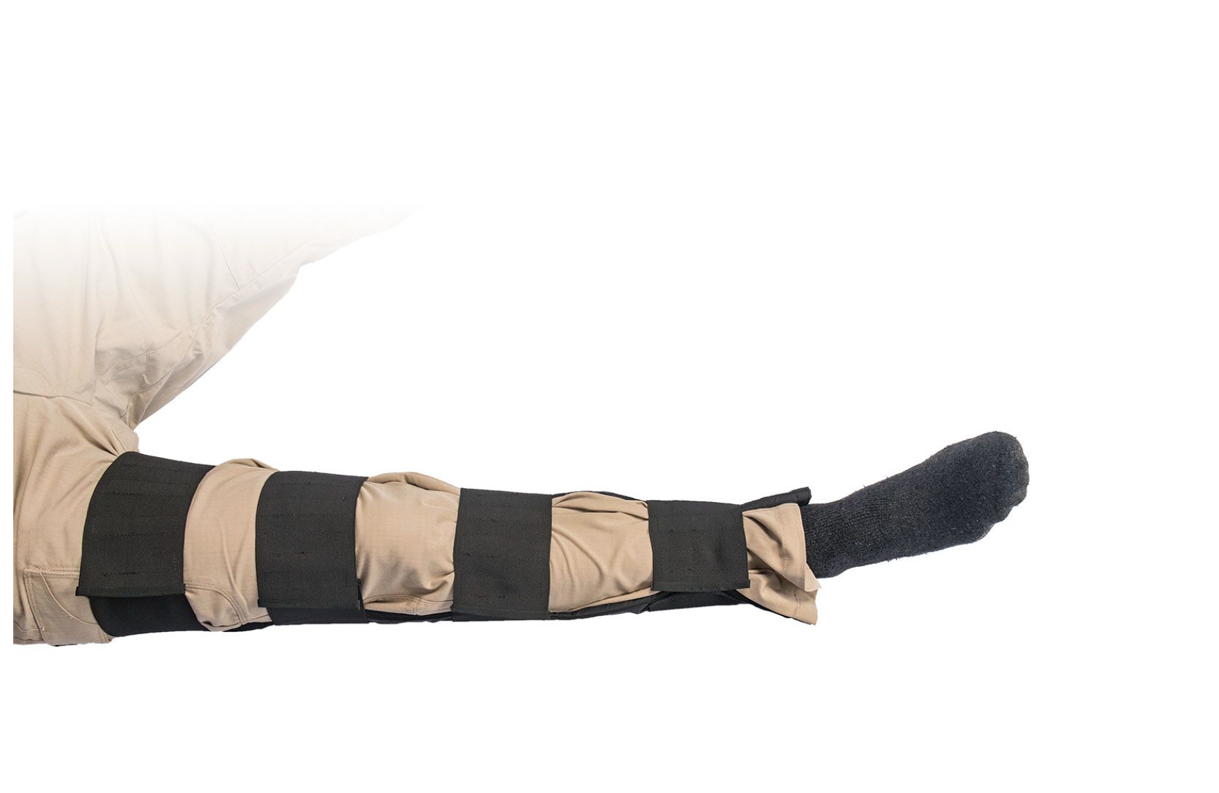 Telescoping Collapsible Splint (TC Splint)