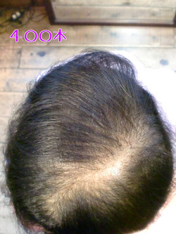 ボリュームアップエクステ増毛ビフォーアフター画像