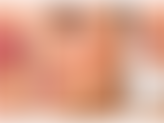 Dermal Fillers Explained: Understanding Your Options for Natural-Looking Facial Rejuvenation