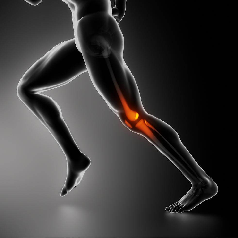 x ray de lesion de rodillas