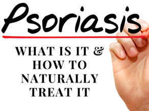 Psoriasis | What is it and natural ways to treat it