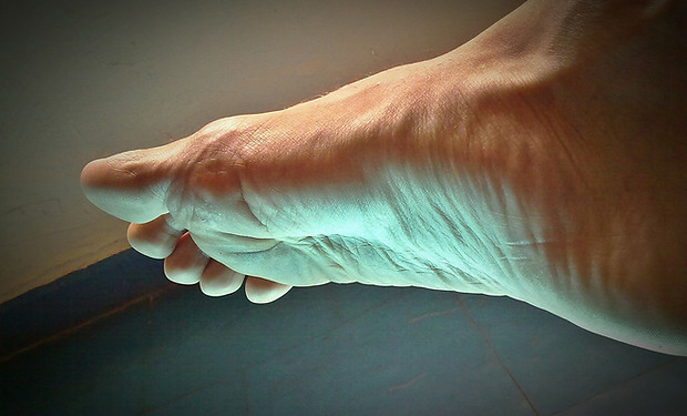 Flat Feet Care