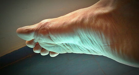 peeling pied