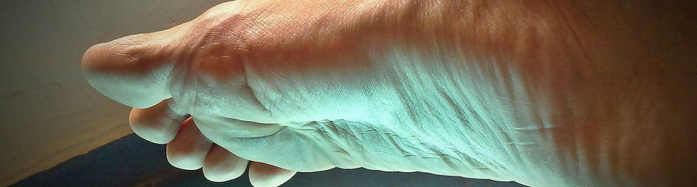 Flat Feet Care