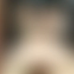 Heartworm in Cats: The Shocking Discovery Under Dragon’s Skin