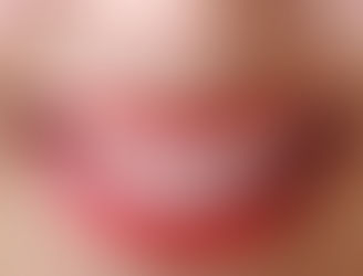 Já é possível ter dentes perfeitos em poucas horas