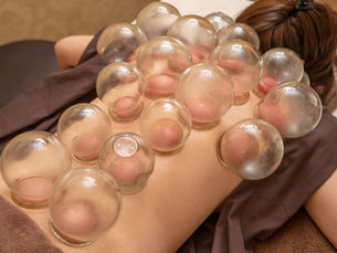 東洋一心堂の吸い玉(カッピング)療法のご紹介