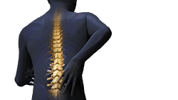 Motor vehicle accident injuires?