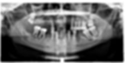 Pines, Patricia 03_02_2018 Panoramic Ima