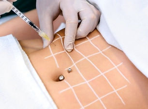 fat dissolving_edited.jpg