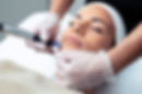 tout-savoir-sur-le-microneedling-maud-dermo-esthetic.jpeg