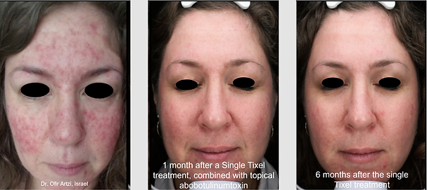 Better Med Spa & Wellness - Tixel Before & After.png