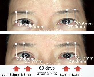 Better Med Spa & Wellness - Tixel Before & After.png